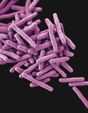 Africa’s laboratories need to step up testing to aid in fighting Anti-Microbial Resistance. This photo is a 3D computer-generated image of Mycobacterium tuberculosis bacteria, the pathogen responsible for causing the disease tuberculosis (TB). Credit: CDC/Unsplash