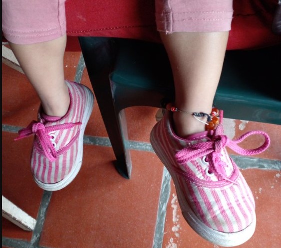 Renowned nutritionist Susana Raffalli published, as an example of a generation of children born and growing up with malnutrition and other problems in Venezuela, a photograph of the legs of a girl who, the day the government-opposition agreement was reached, was eight centimeters shorter than the appropriate size for her age. CREDIT: Susana Rafalli/Twitter