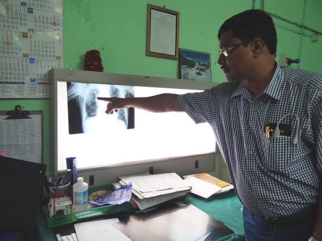Dr Abhijit Bhattacharya, MS, Central Hospital Kalla, Eastern Coalfields Ltd., assesses an x-ray of a TB patient. Credit: ILO